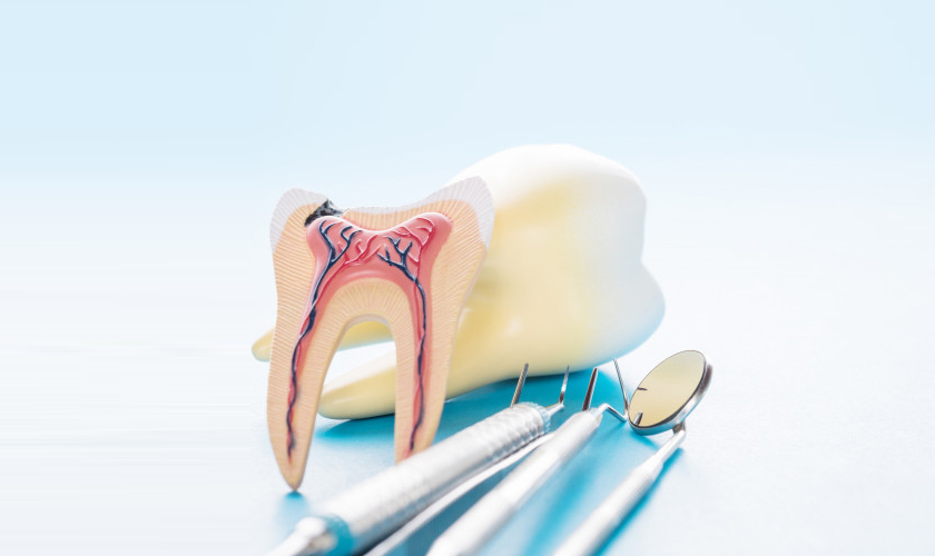 root canal treatment