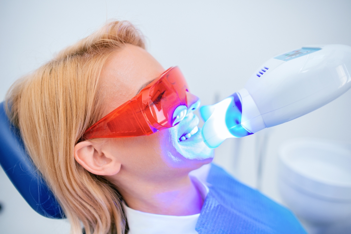 Laser-Whitening-in-Irving