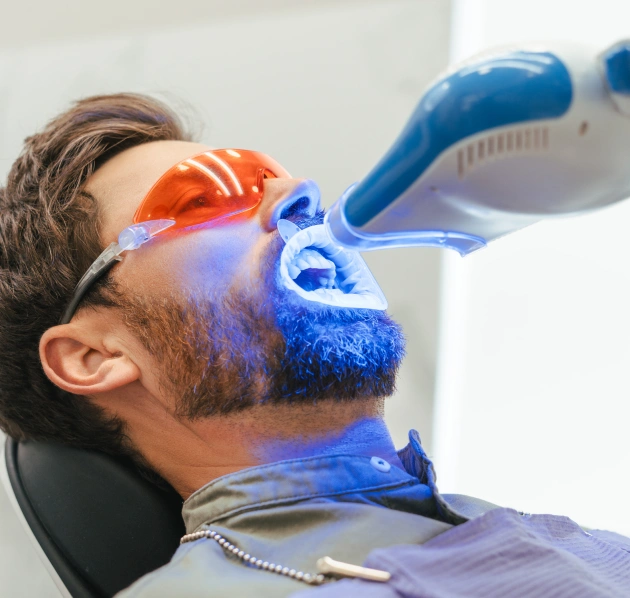 Laser Teeth Whitening