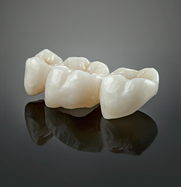 Get a Beautiful, Functional Crown in Just One Visit